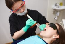 Brisbane Veneers